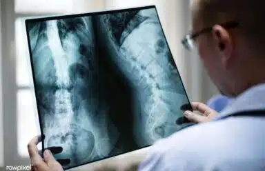 Plano negou prótese ou stent? Seus direitos