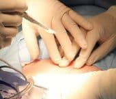 Negativa de cobertura para cirurgia bariátrica