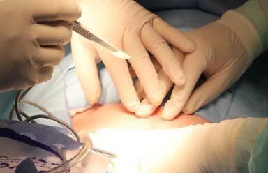 Negativa de cobertura para cirurgia bariátrica