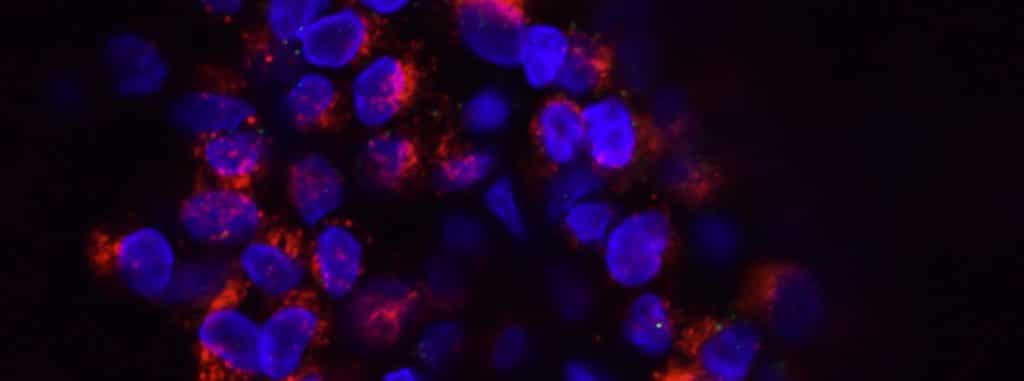 plano-de-saúde-deve-cobrir-oncotype-dx®