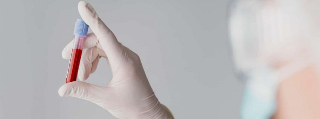 plano-de-saude-cobre-mozobil-plerixafor