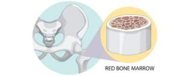 Como é feita a doação de medula óssea?