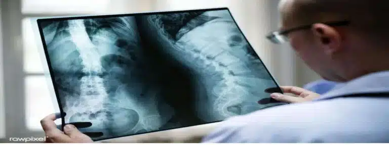 Dalinvi® (Daratumumabe): mieloma múltiplo e plano de saúde