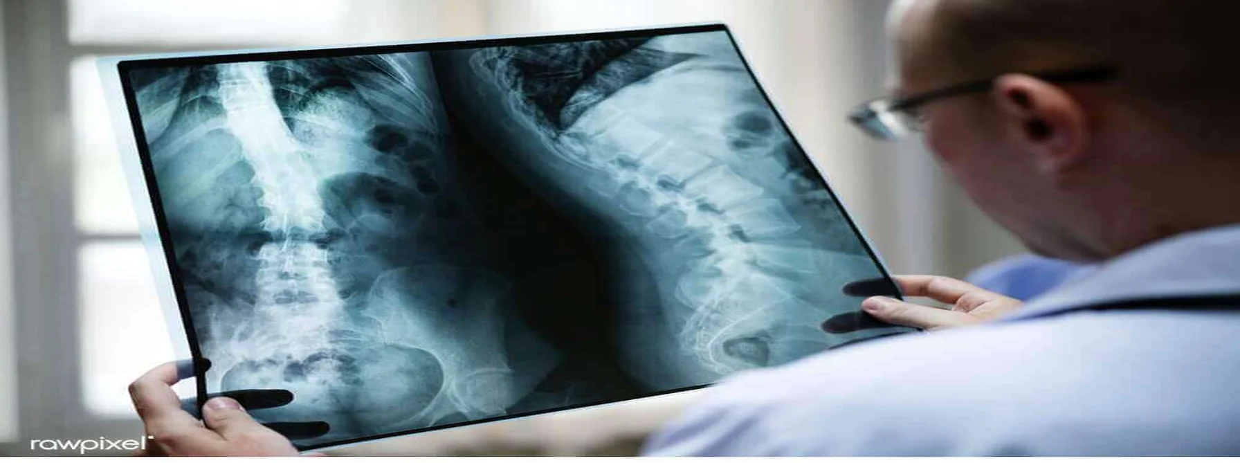 Daratumumabe (Dalinvi®)