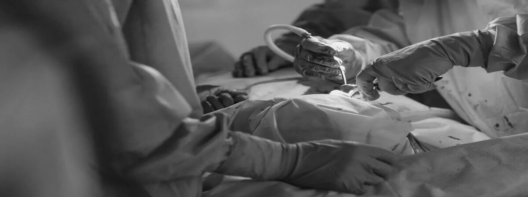 Nefrectomia Parcial Robótica pelo plano de saúde