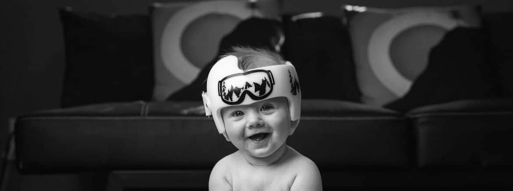 Plano de saúde deve fornecer capacete de órtese craniana