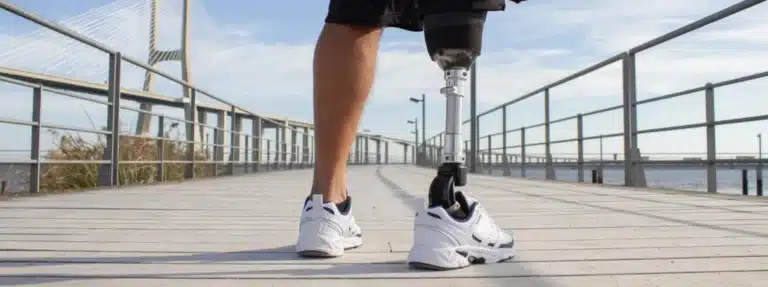 Prótese de perna pelo plano de saúde